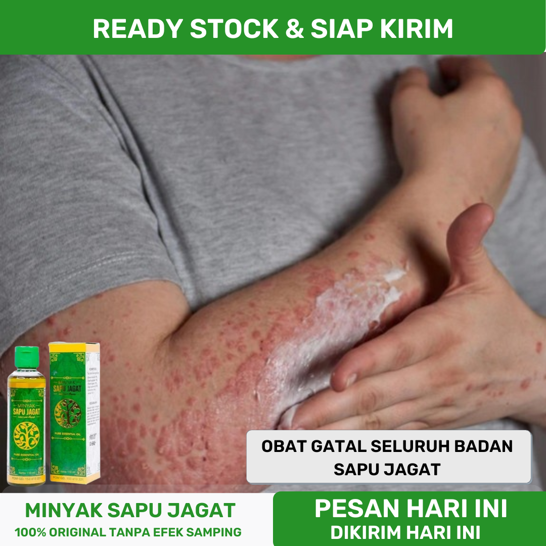 Obat Gatal Gatal Di Seluruh Badan Obat Alergi Kulit Obat Gatal Di