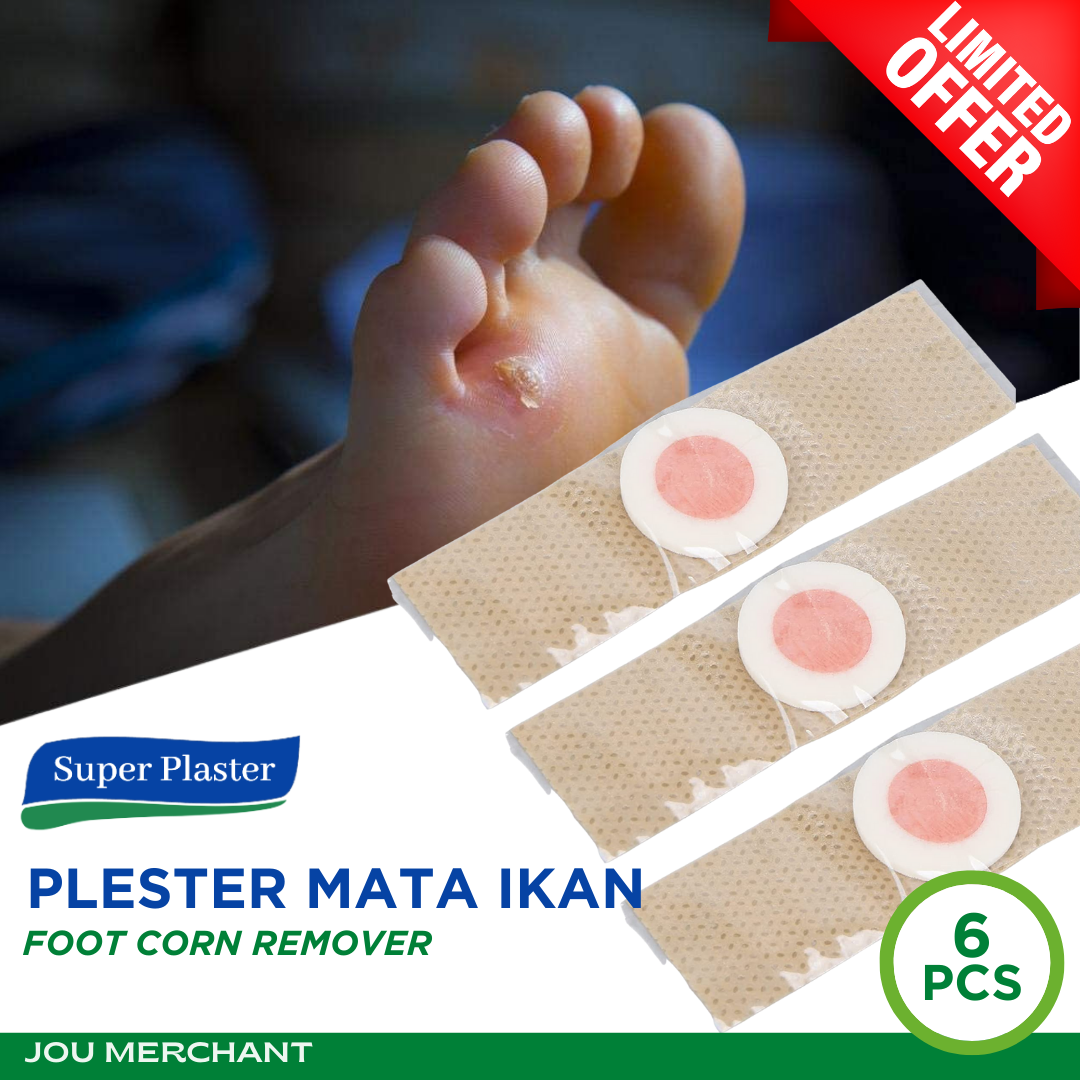 Plester Mata Ikan Dan Kutil 6 Pcs 1 Strip Obat Mata Ikan Kapalan