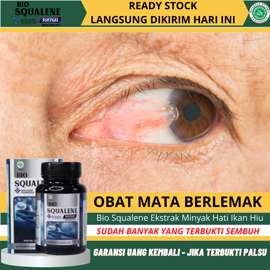 Obat Mata Berlemak Kekuningan Obat Pembersih Selaput Mata Obat