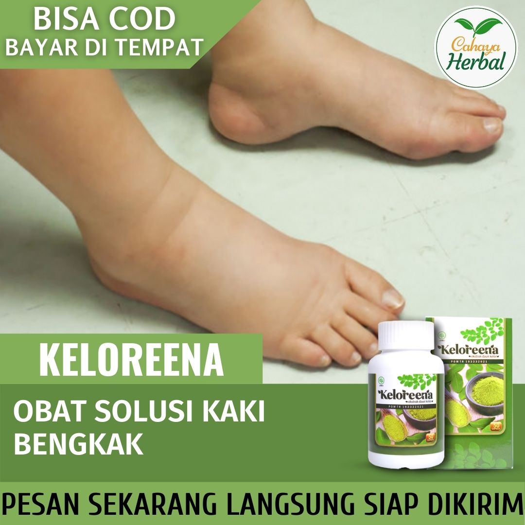 Daun Kelor Ramuan Obat Kaki Bengkak Obat Pengempis Bengkak Kaki