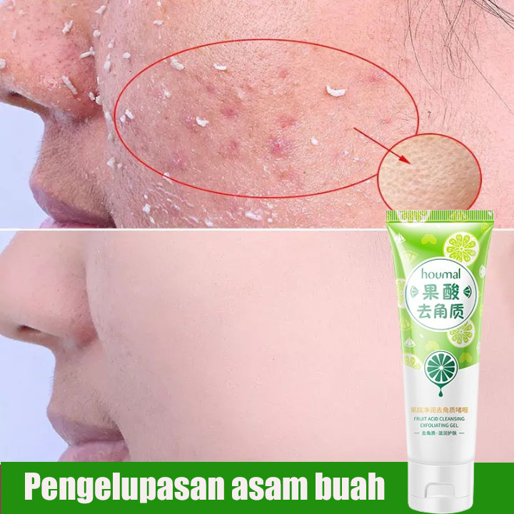 Gr Fruit Acid Exfoliating Gel Penghilang Daki Facial Glowing