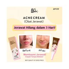 EverWhite Acne Cream Obat Jerawat BPOM