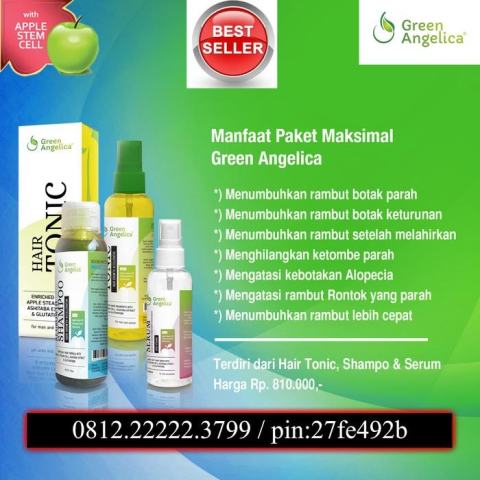 OBAT RAMBUT TERBAIK DI INDONESIA DIPAKAI PARA ARTIS INDONESIA