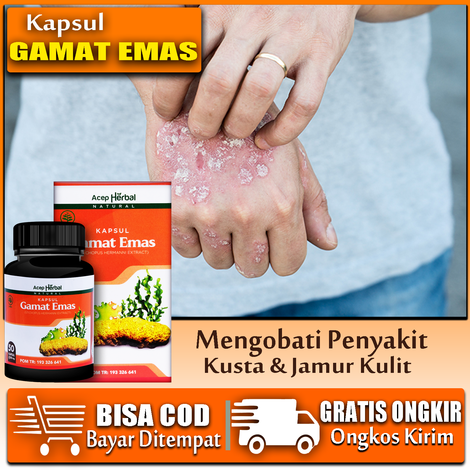 Obat Herbal Kusta Jamur Kulit Obat Kusta Lepra Obat Infeksi Kulit