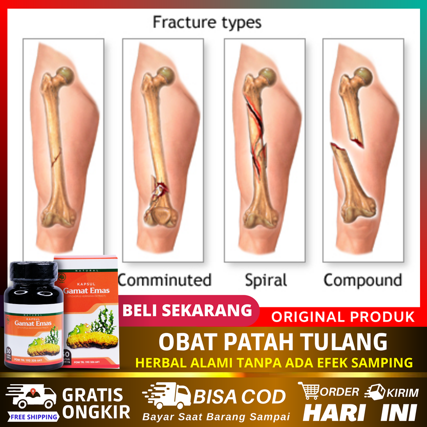 Obat Patah Tulang Retak Sambung Tulang Ampuh Tulang Bengkak Keropos