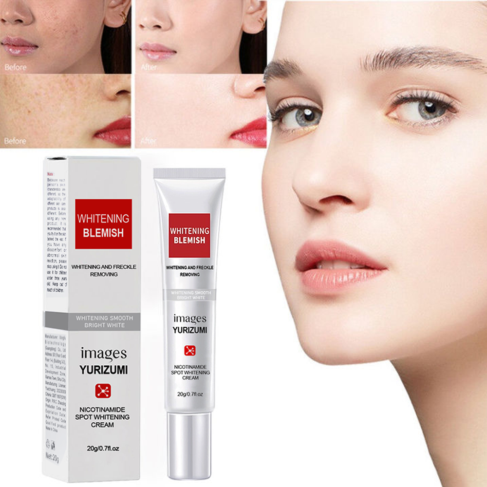 Yurizumi Whitening Freckle Cream Remove Dark Spots Anti Freckle Cream