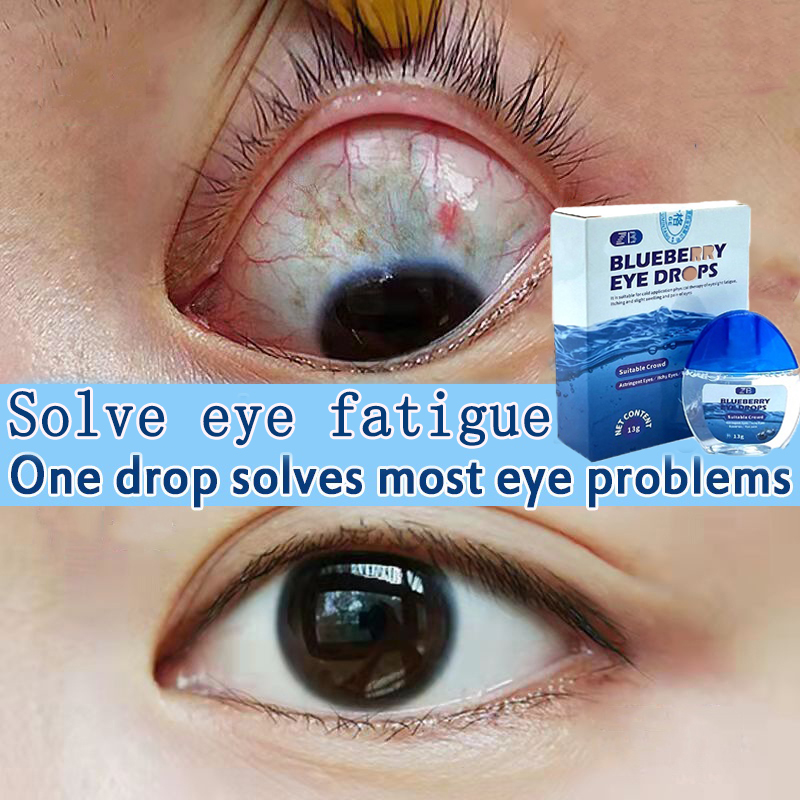 Obat Tetes Mata Tetes Mata Herbal Tetes Mata Alami Eye Drop Mengandung