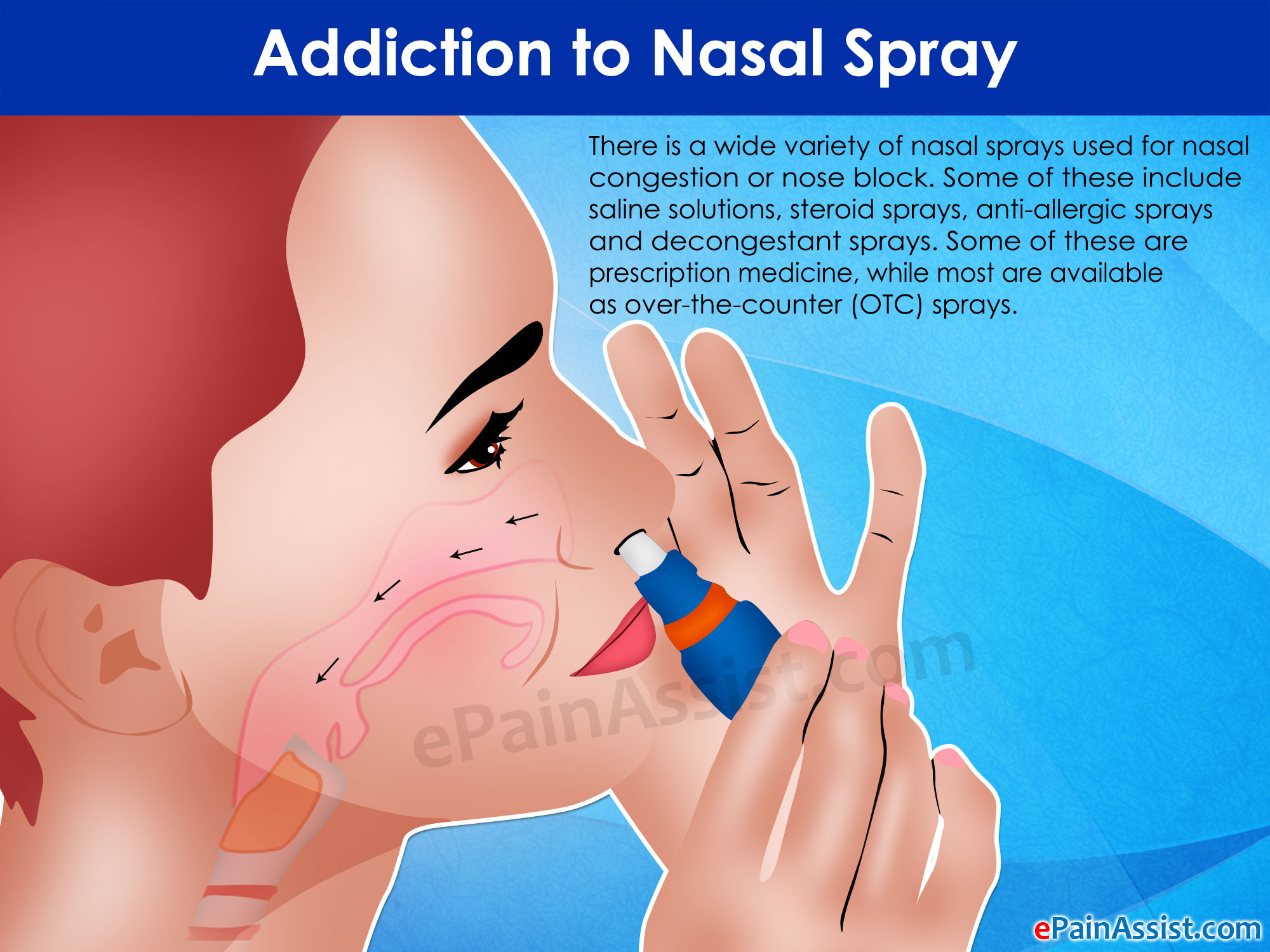 Nasal Spray Types And How To Use Them