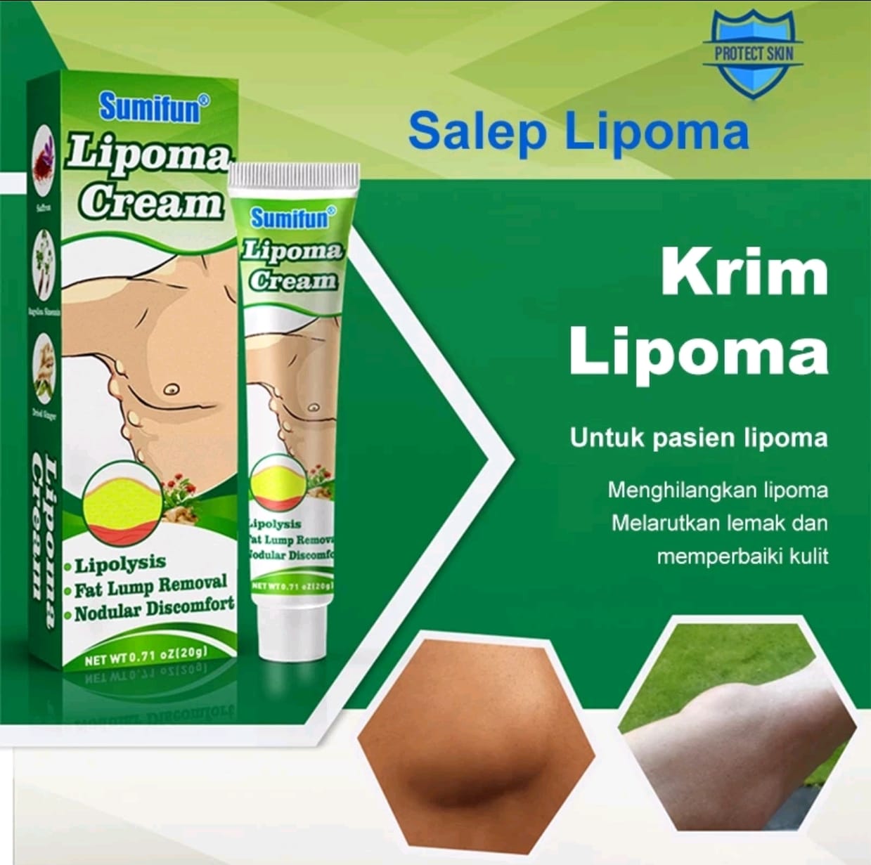 Lipoma Cream Salep Lipoma Mengatasi Masalah Benjolan Di Badan Leher