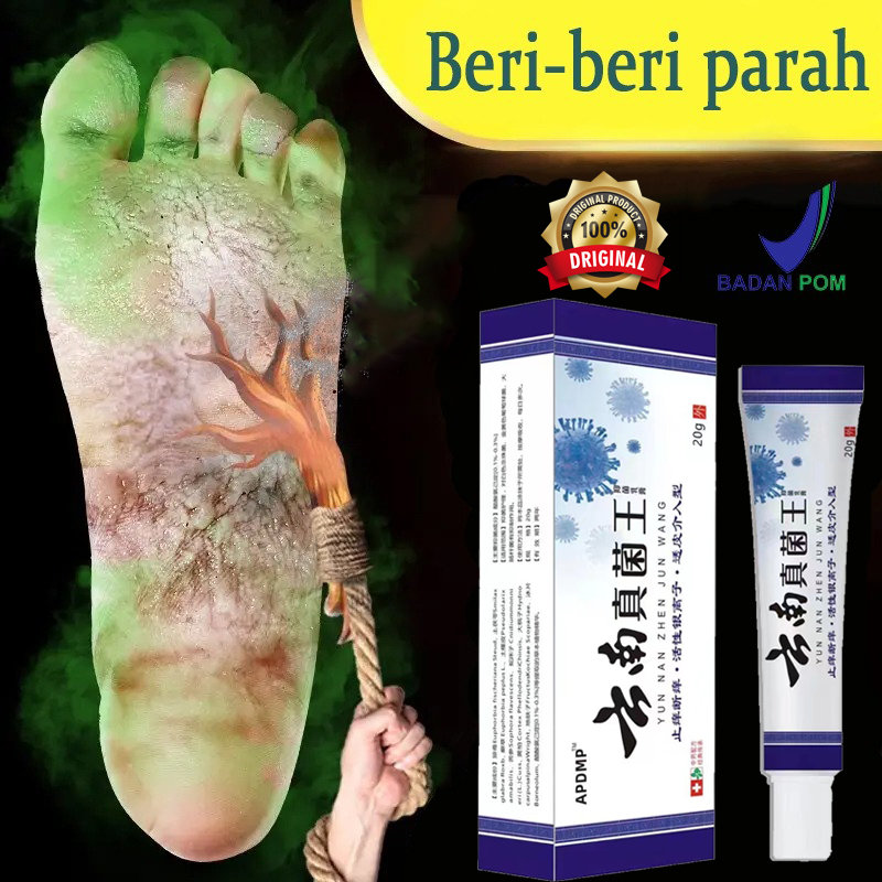 Penghilang Bau Kaki Obat Jamur Kaki Foot Salep G Anti Gatal Cepat