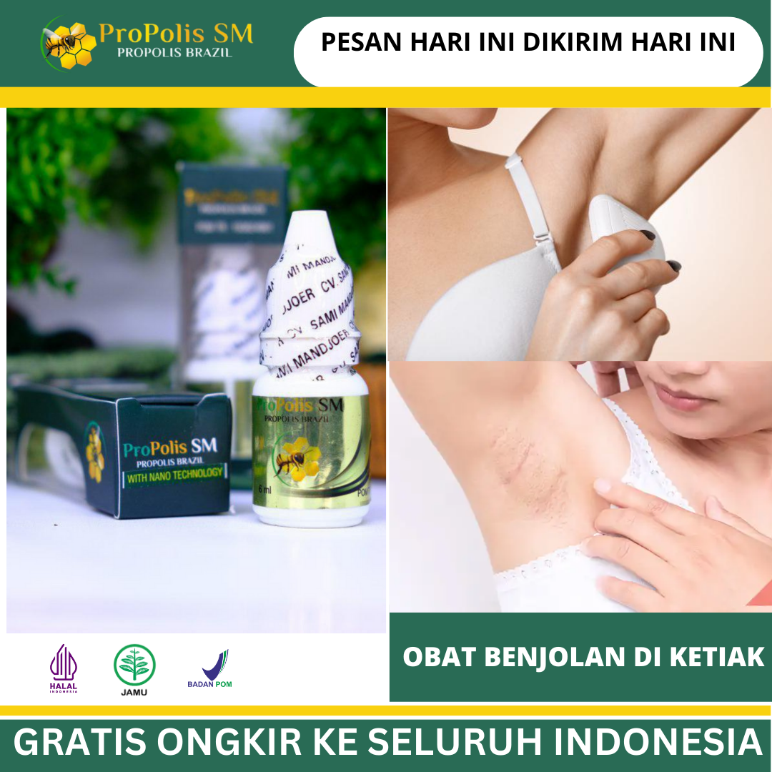 Obat Benjolan Di Ketiak Obat Benjolan Di Ketiak Propolis Sm Obat