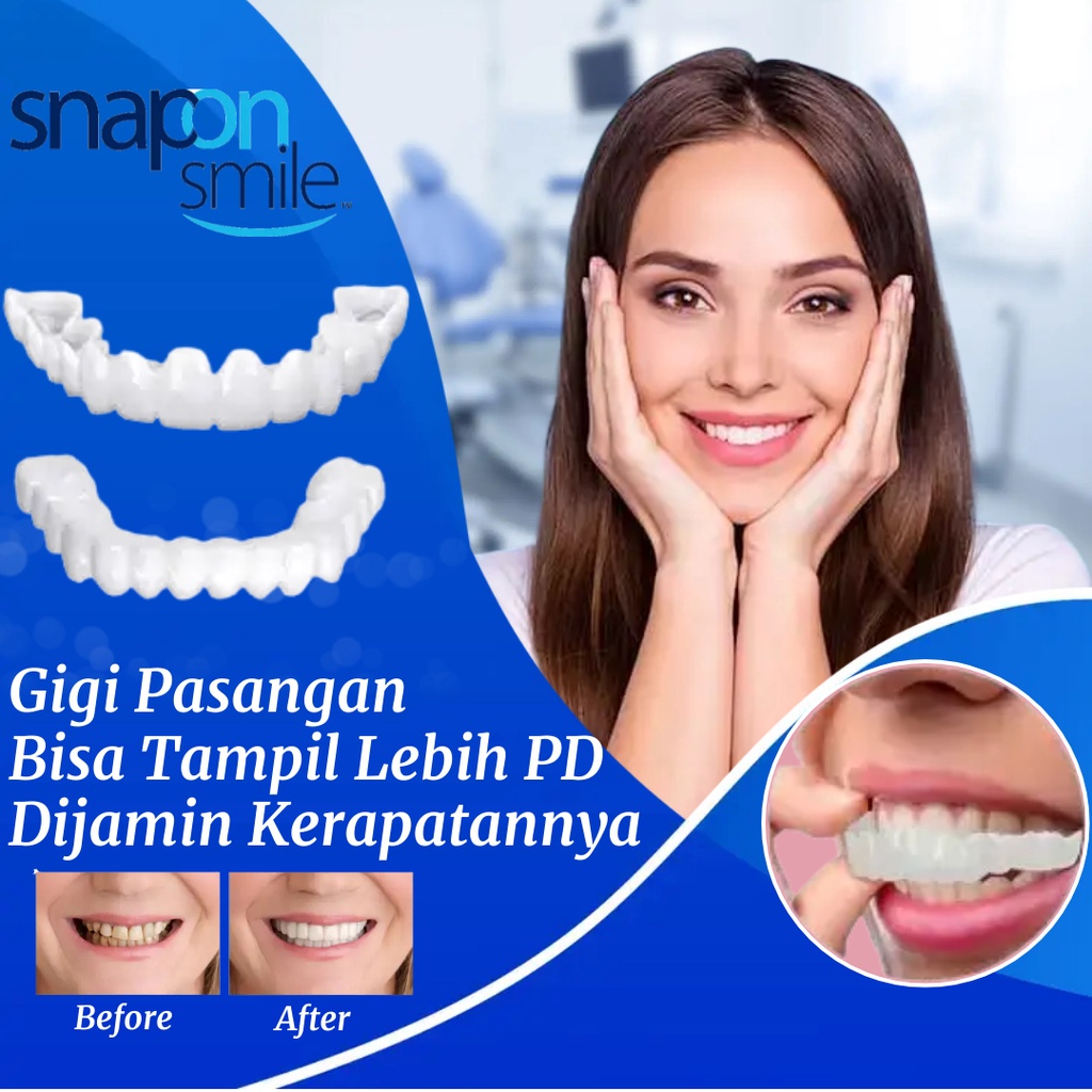 Snap On Smile Set Atas Bawah Tambal Gigi Permanen Dokter Tambal Gigi