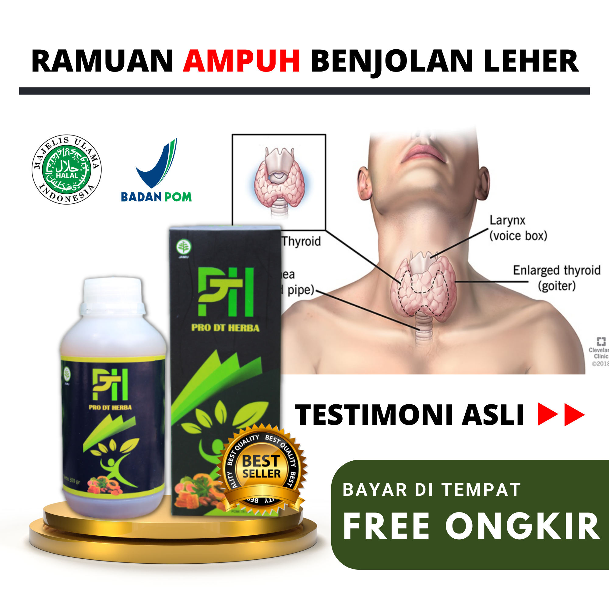 Obat Kelenjar Tiroid Di Leher Tumor Ganas Dan Jinak Penyakit Getah