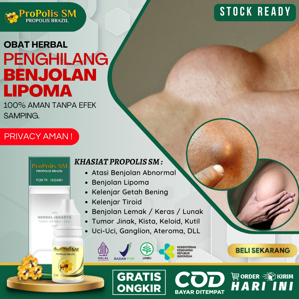 Obat Benjolan Lipoma Penghancur Lipoma Penghilang Lipoma Benjolan