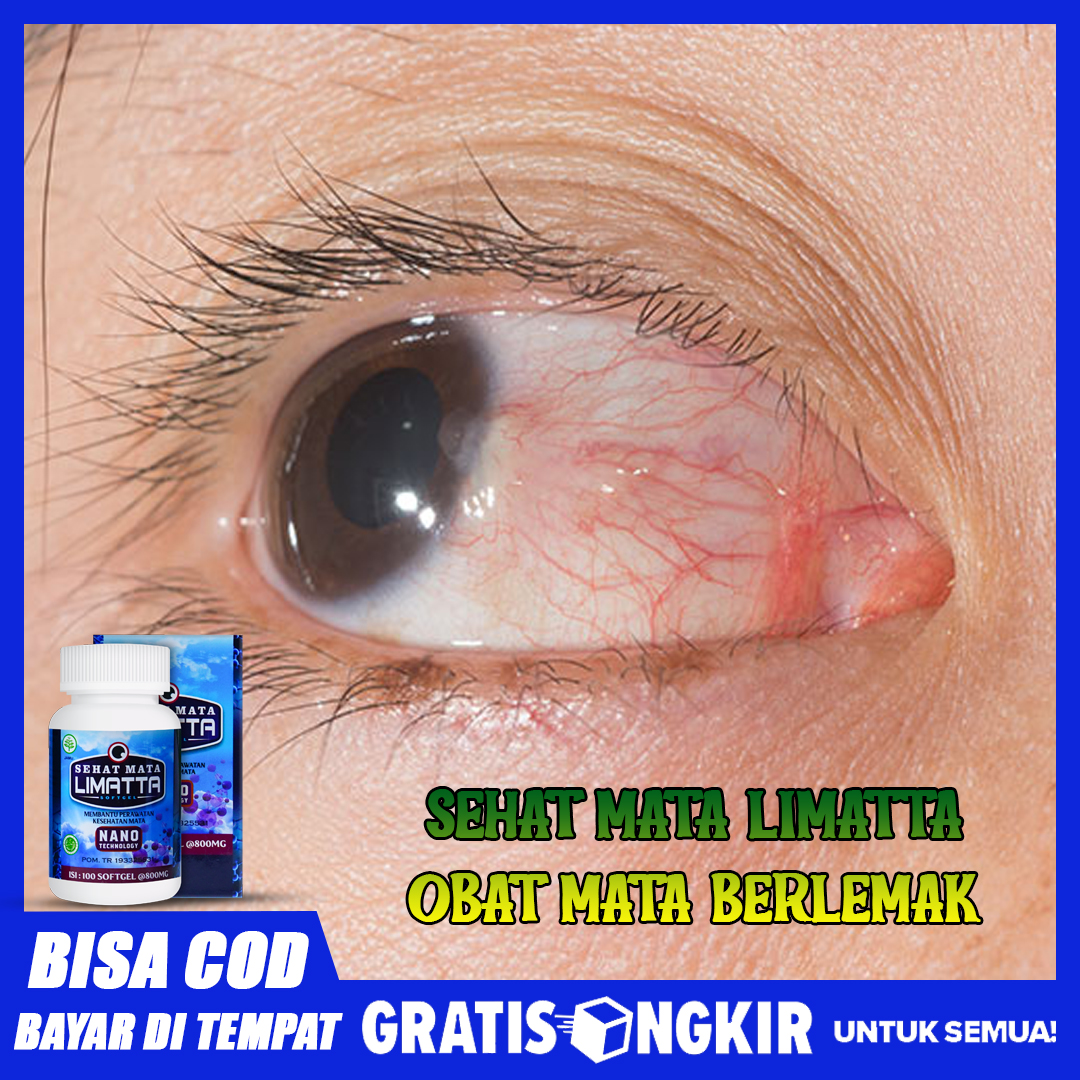 Obat Atasi Penyakit Mata Berlemak Pterygium Pterigium Pengobatan