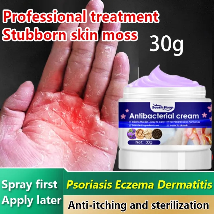 Salep Khusus Psoriasis Import Kurap Pada Kulit Kepala Kutu Air