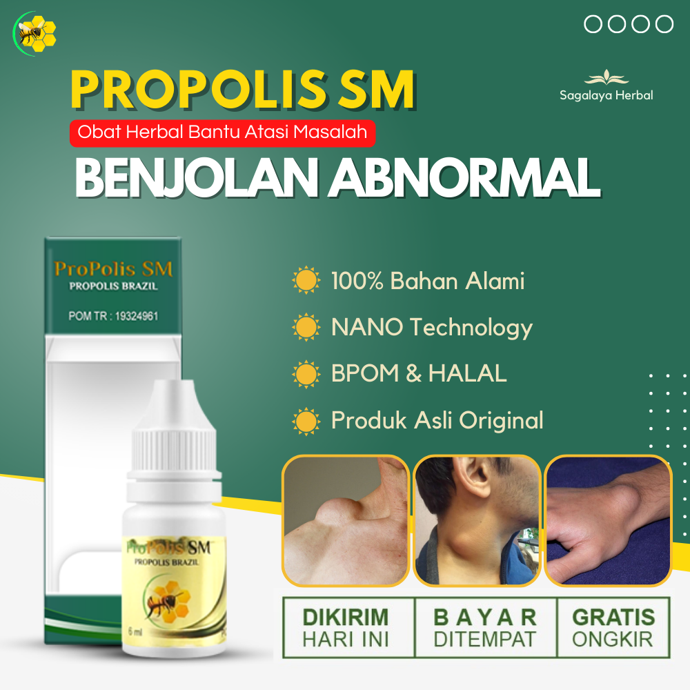 Obat Herbal Untuk Mengobati Benjolan Abnormal Di Tubuh Penghilang