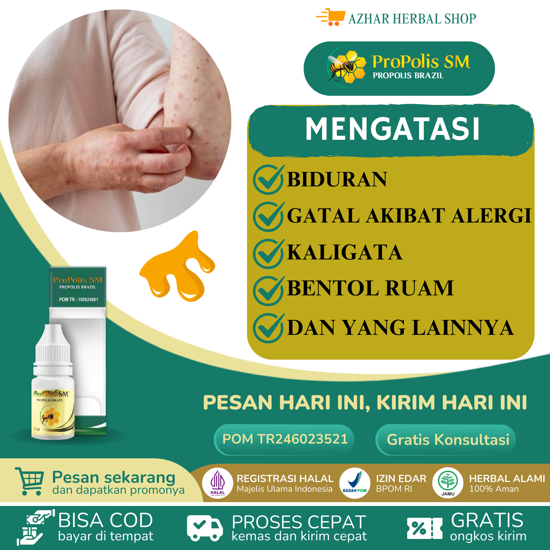 Propolis SM Obat Biduran Gatal Alergi Dingin Makanan Kaligata Bentol