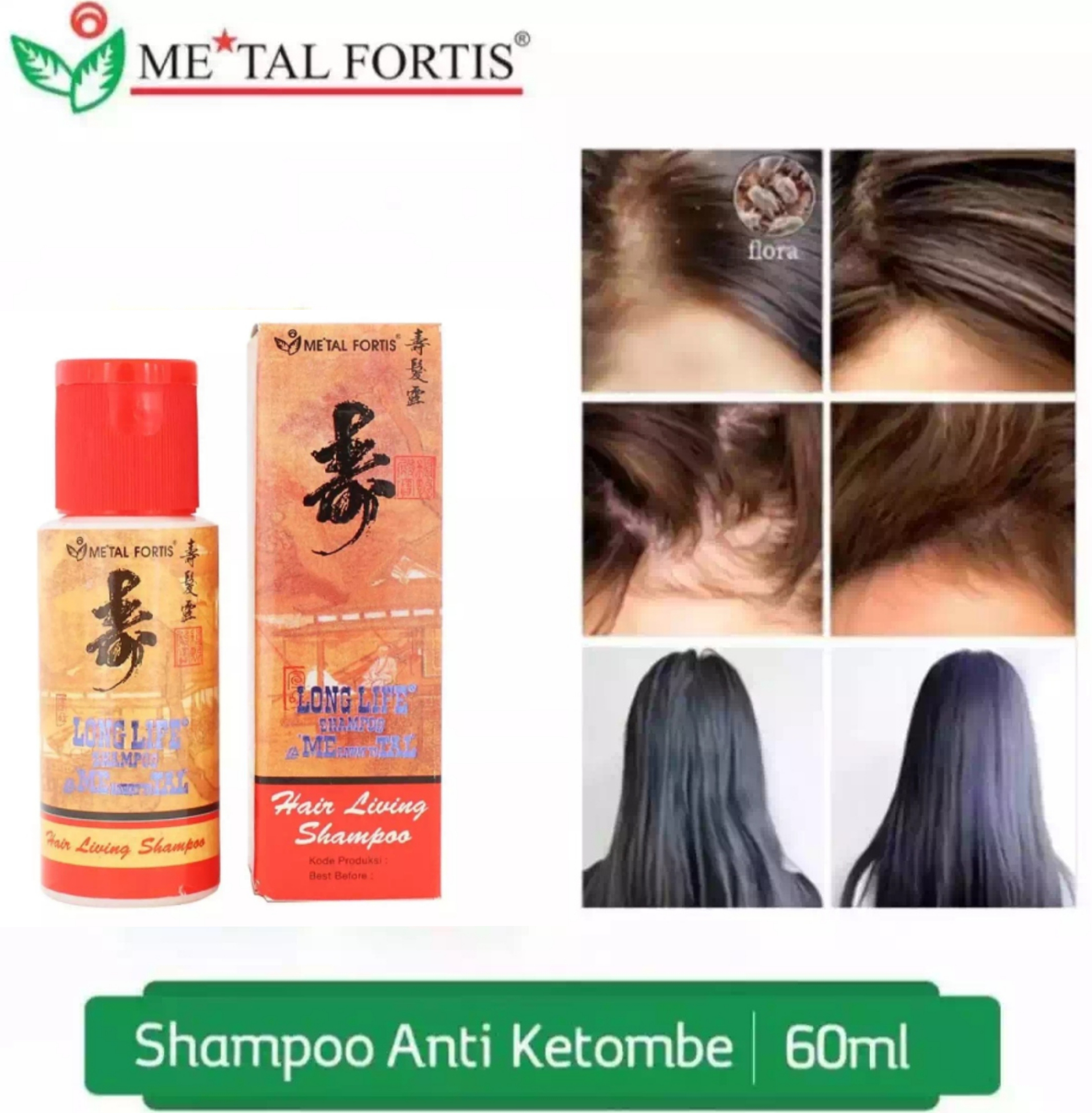 Apakah shampo metal bisa memanjangkan rambut
