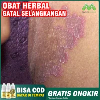 Jual Selangkangan Gatal Hitam Terbaru Lazada Co Id