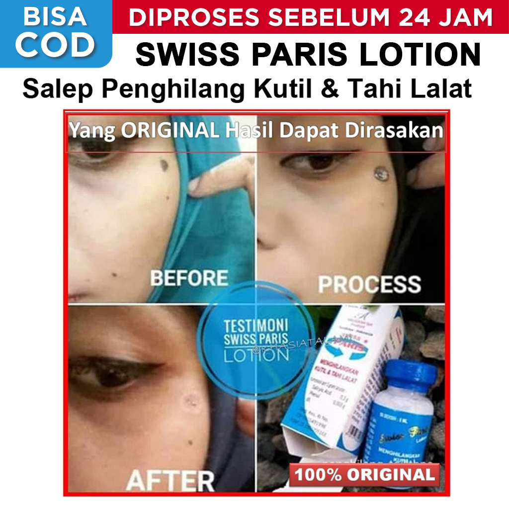 Swiss Paris Lotion 100 Murni dan Ori Penghilang Tahi Lalat Kutil Yang