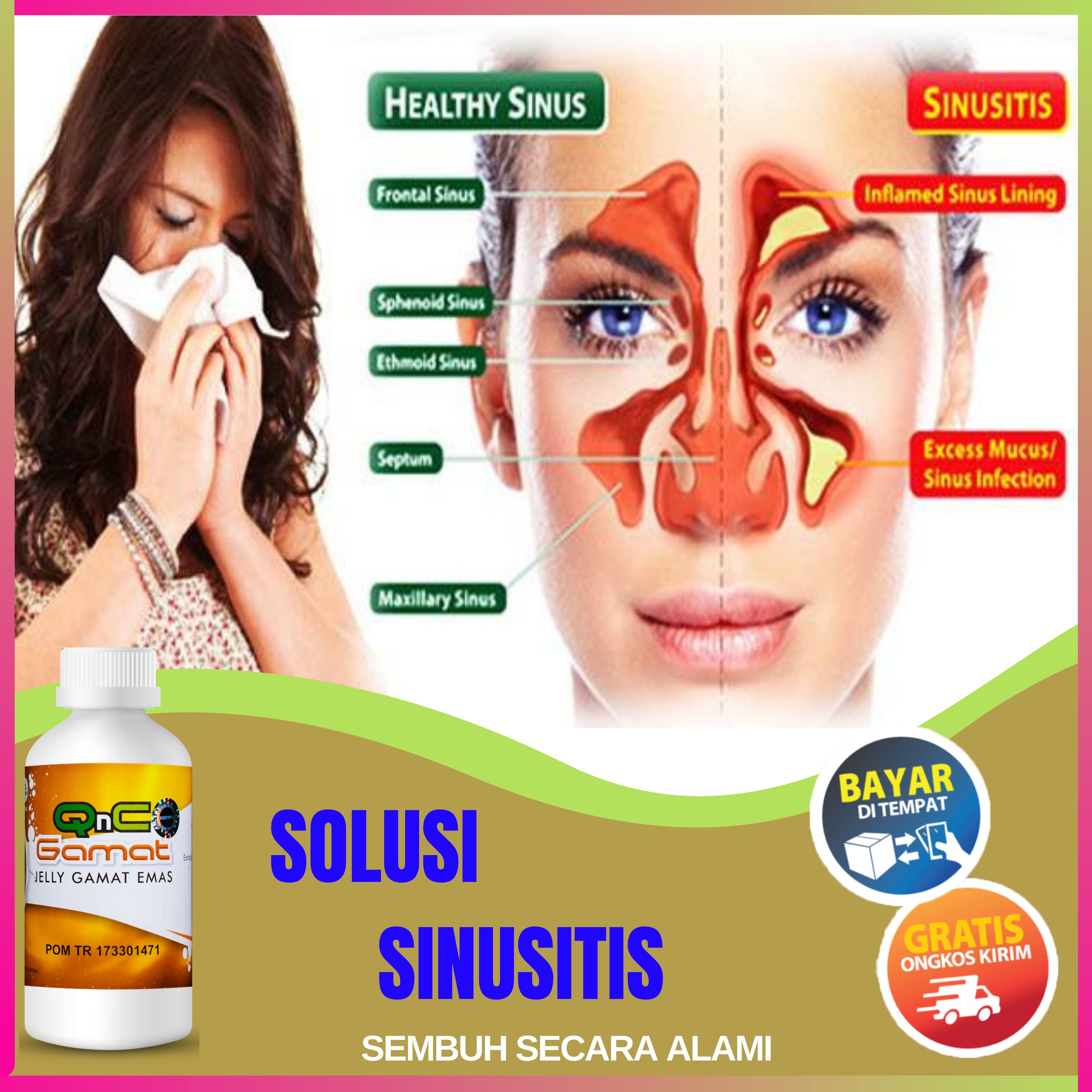 Obat Penyembuh Sinusitis Akut Rhinitis Kronis Pilek Menahun Radang