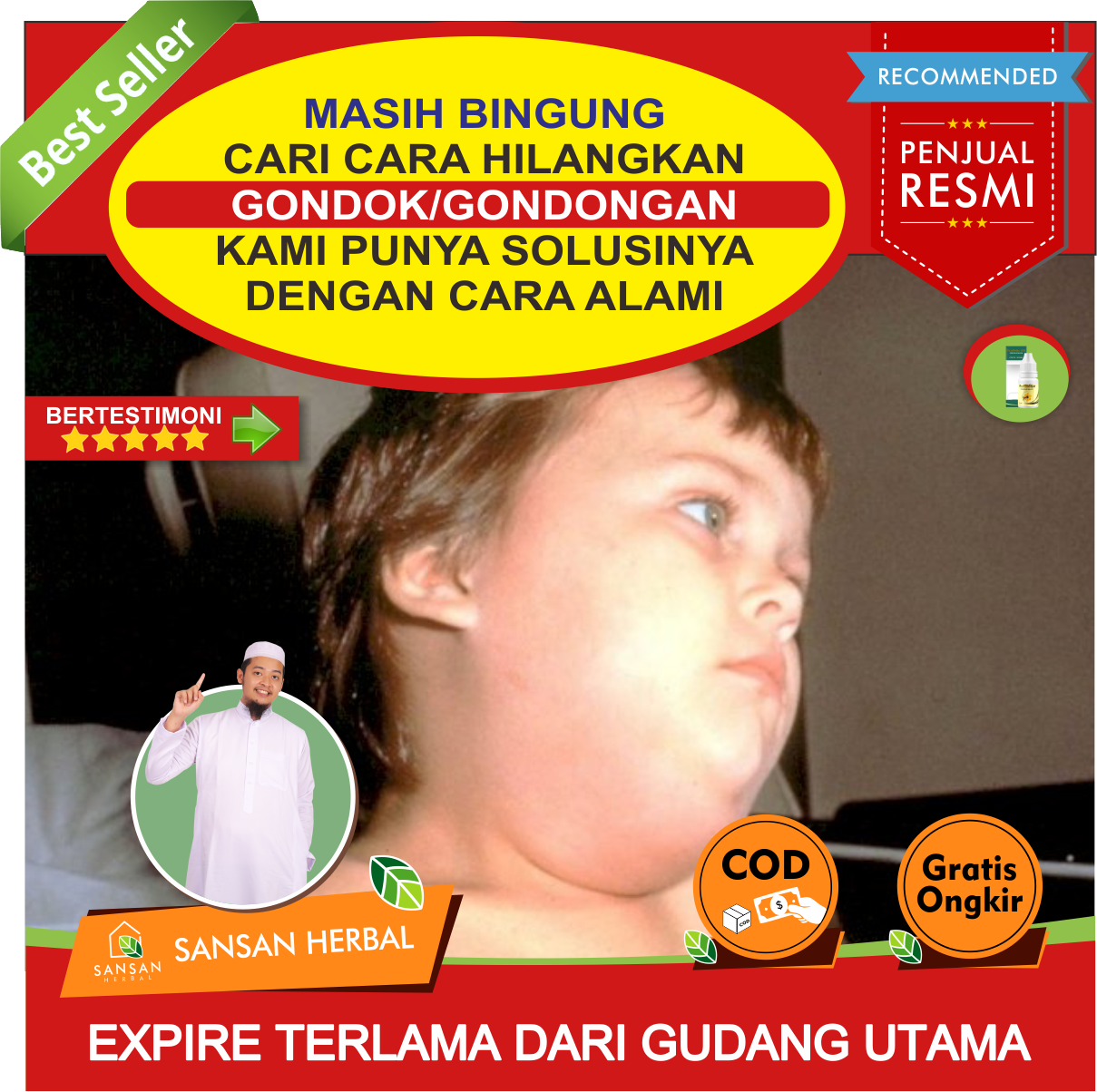 Salep Gondongan Tradisional, Gondongan Kelenjar Getah Bening, Penyakit ...