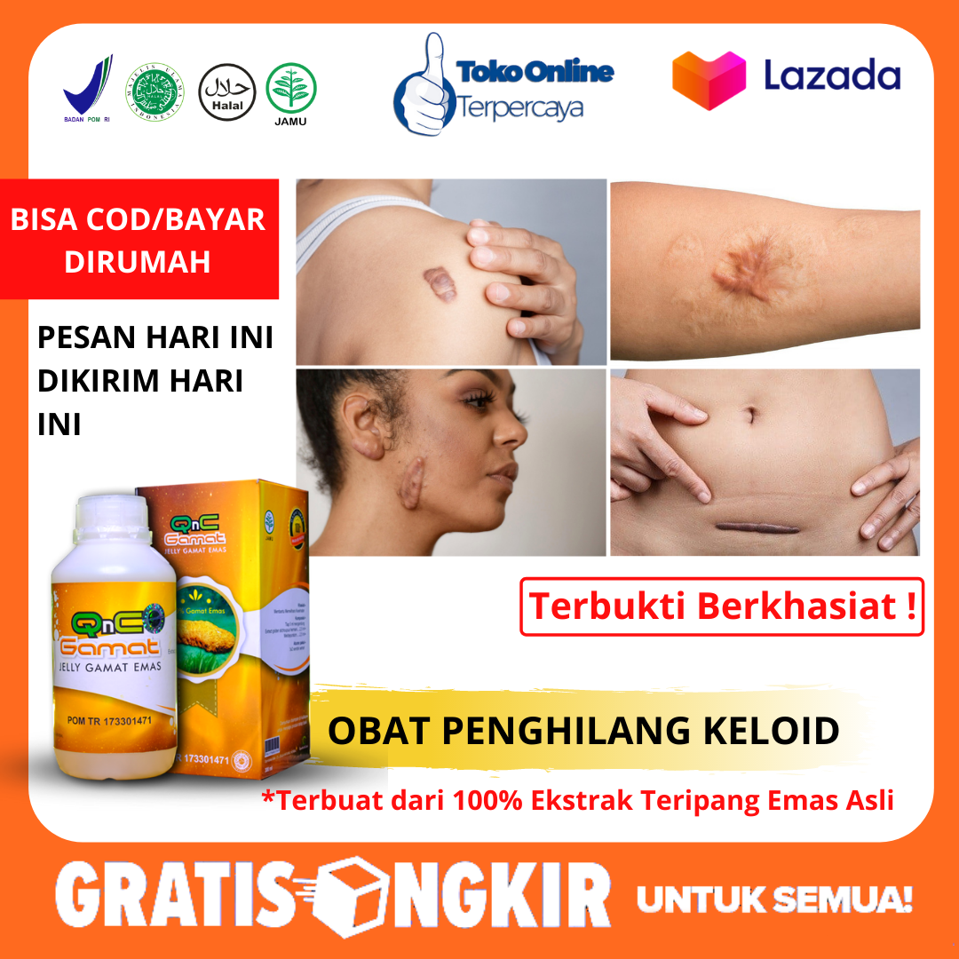 Menghilangkan keloid bekas operasi