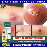 24++ Salep untuk jerawat di kemaluan pria di apotik ideas