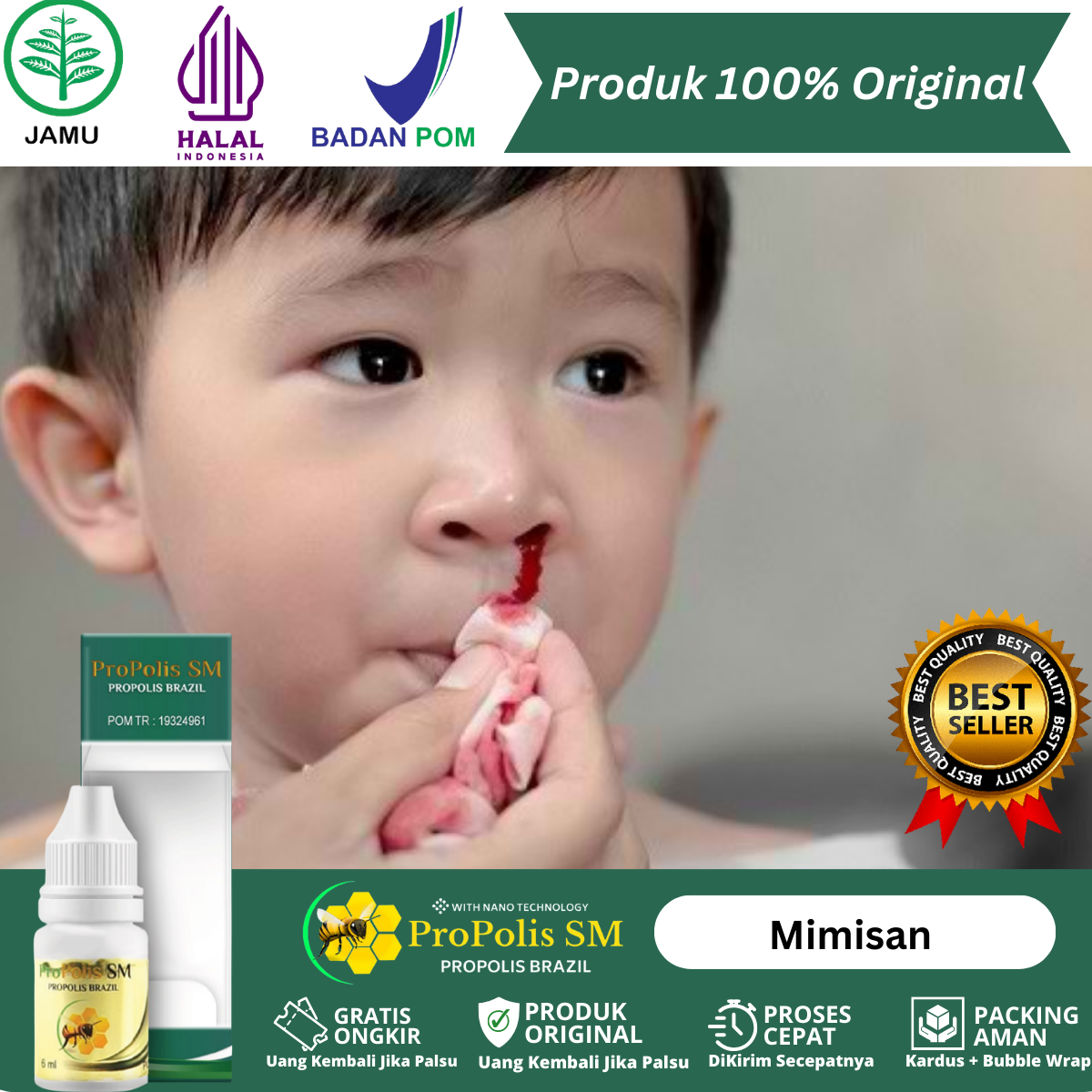 Obat Mimisan, Obat Hidung Keluar Darah, Obat Hidung Mimisan Untuk Anak Dan Dewasa, Obat Sering