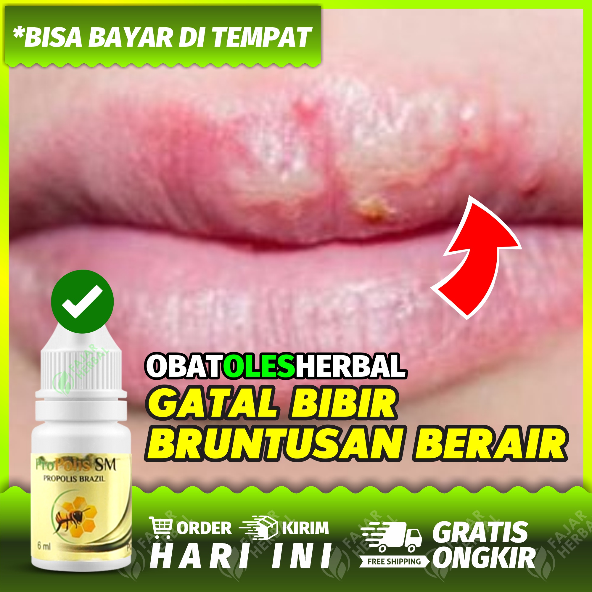 Obat bibir gatal , bibir gatal berair, bibir gatal dan ada bintik kecil