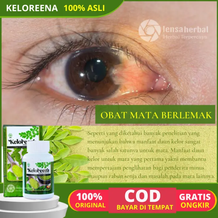 Inilah Manfaat Daun Kelor Untuk Mata Berlemak 