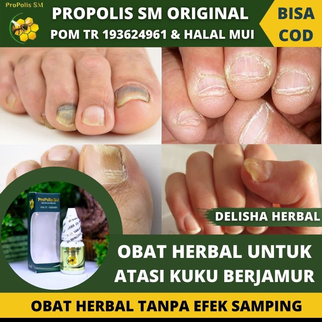 Jual Obat Pembersih Kuku Kaki Terbaru Lazada Co Id