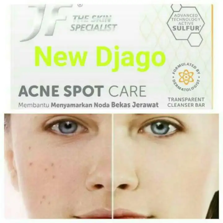 jf sulfur acne spot care
