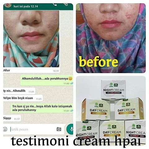 Day Cream dan Night cream HNI HPAI | Lazada Indonesia