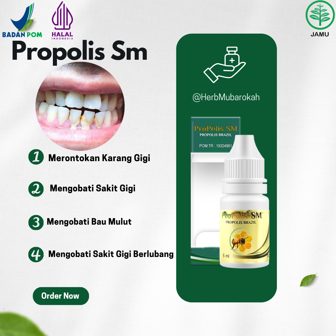 Obat Membersihkan Karang Gigi, Obat Karang Gigi Parah, Karang Gigi