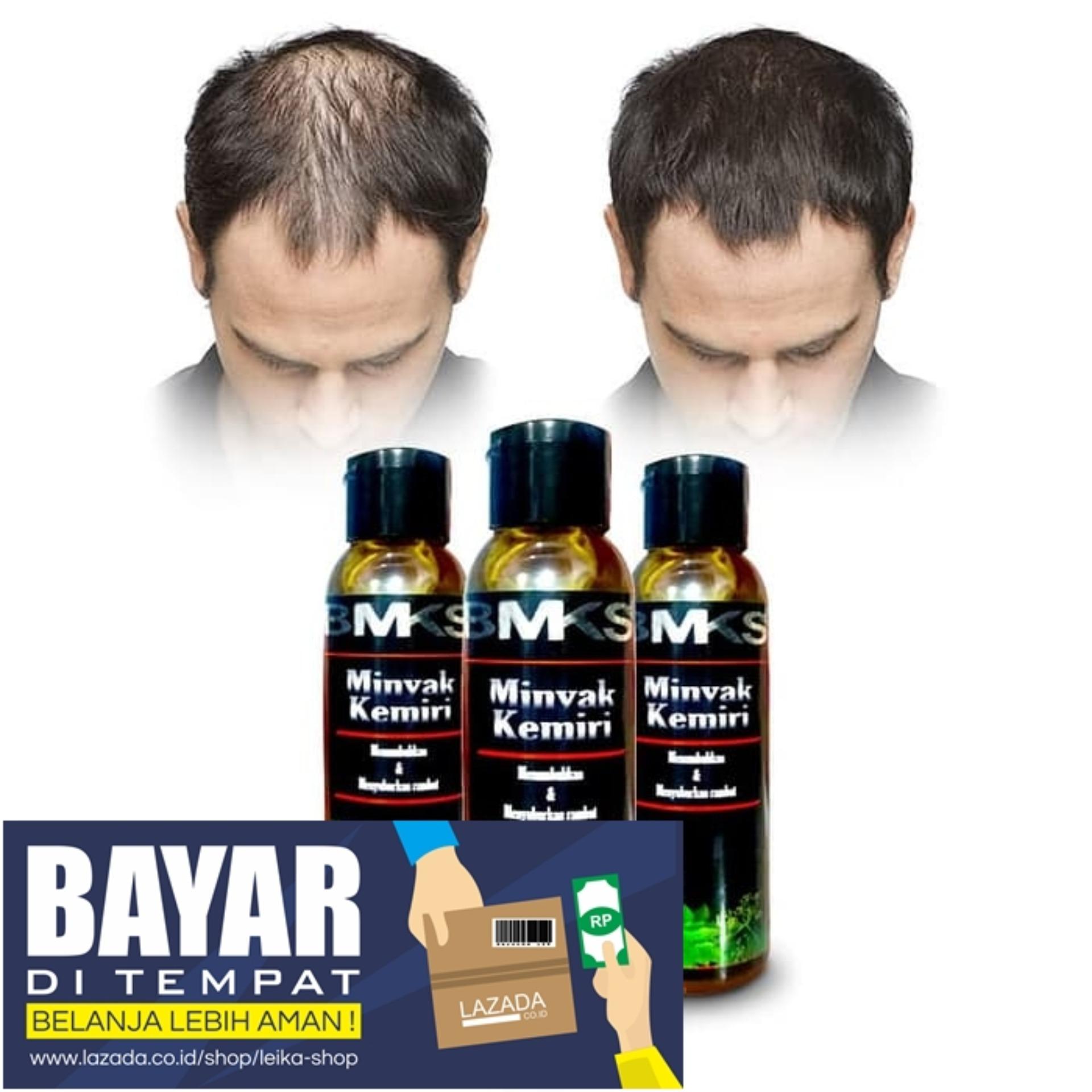 Penumbuh Rambut Secara Cepat Panjang Botak Permanen Original Minyak Kemiri Asli 100 Bmks Bpom Minyak Kemiri Penumbuh Rambut Minyak Rambut Kemiri Vitamin Rambut Kering Rontok Botak Cepat Pria Wanita Obat Rambut Rontok