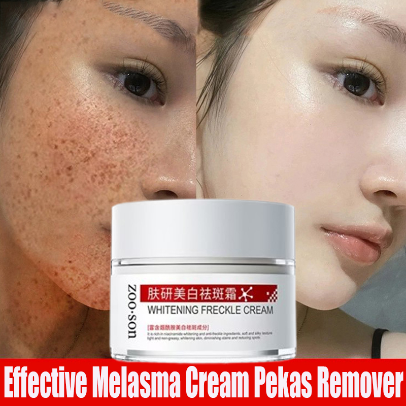 Whitening Freckle Cream Remove Dark Spots Krim Flek Fuyanandorheal Melasma Cream Kelupas Krim 0703