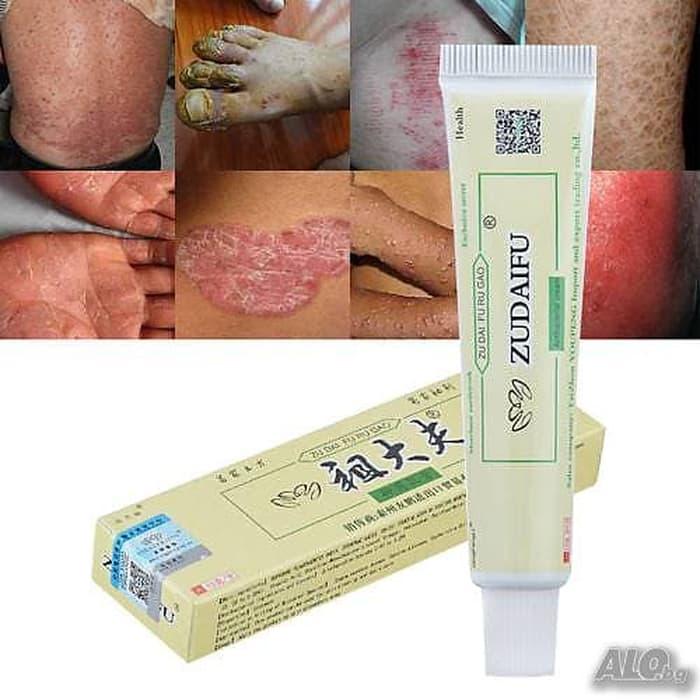 Salep Eksim Psoriasis Jerawat Ruam Jamur Kudis Kurap Beri Beri Zudaifu By Asep Jemi Meliyana.