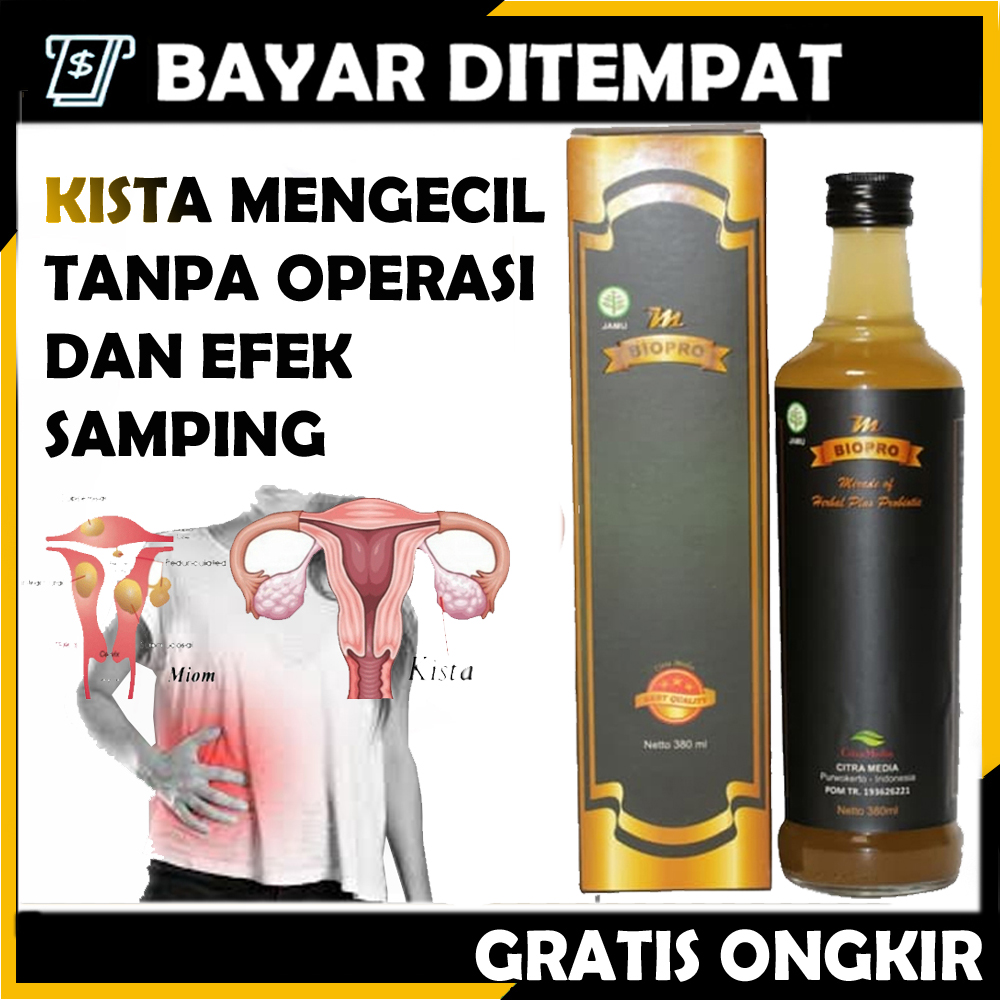 Obat Kista Obat Kista Ovarium Paling Ampuh Obat Kista Herbal Obat Kista Coklat Obat Kista Ampuh Obat Kista Endometriosis Obat Kista Ganglion Obat Kista Bartholin Lazada Indonesia