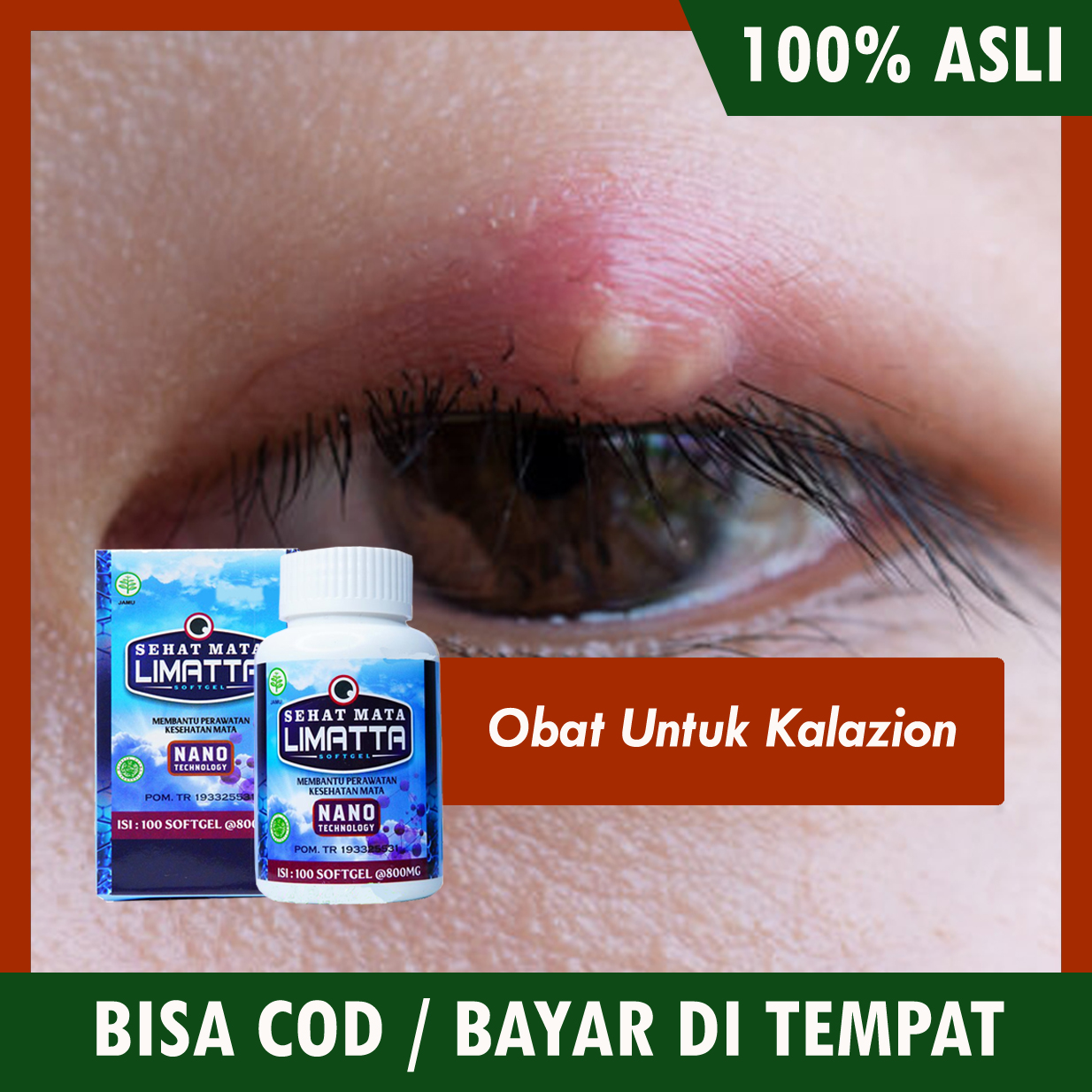 Obat Untuk Kalazion Obat Penghilang Mata Bintitan Obat Penghilang Benjolan Di Kelopak Mata Obat Mata Bintitan Untuk Anak Dan Dewasa Obat Bintitan Kalazion Chalazion Limatta Sehat Mata Original Lazada Indonesia