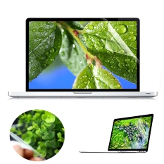 Autoleader Universal 15,6 inci W pelindung layar LCD Laptop untuk Laptop Notebook 16:9 - International