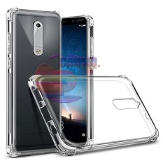 Case Anti Shock Nokia 5 Ultrathin Anti Crack Elegant Softcase Anti Jamur Air Case 0.3mm / Silicone Nokia 5 / Soft Case / Silikon Anti Crack / Case Hp / Case Nokia 5 / Pelindung Hp - Putih Transparant