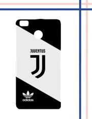 Casing Gambar Motif HARDCASE Untuk Xiaomi Mi Max 2 Juventus new logo adidas Z4735 Case