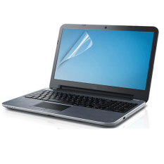 COOSKIN Anti Silau Mate Pelindung Layar LCD Laptop For Lebar 14 Inci Film For Komputer Notebook Mendukung Layar Sentuh 309,5 MM X 174,5mm-Internasional