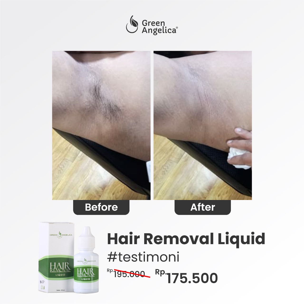Cantik Amanah Green Angelica Hair Removal Perontok Bulu Permanen