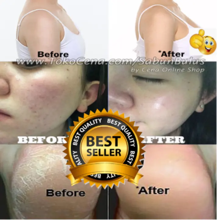 Lucky Cod Sabun Ireng Dr Glow Sabun Bulus Original Mbak Ireng Bpom Sabun Bulus Pembesar Payudara Pengencang Payudara Pembesar Bokong Pembesar Pantat Free Gantungan Kunci Lucu 1 Pcs Lazada Indonesia