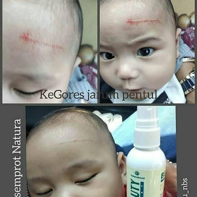 Asli Natura Beauty Spray Glutathione Collagen Whitening Original Natura World Lazada Indonesia 2,139 likes · 7 talking about this. asli natura beauty spray glutathione collagen whitening original natura world