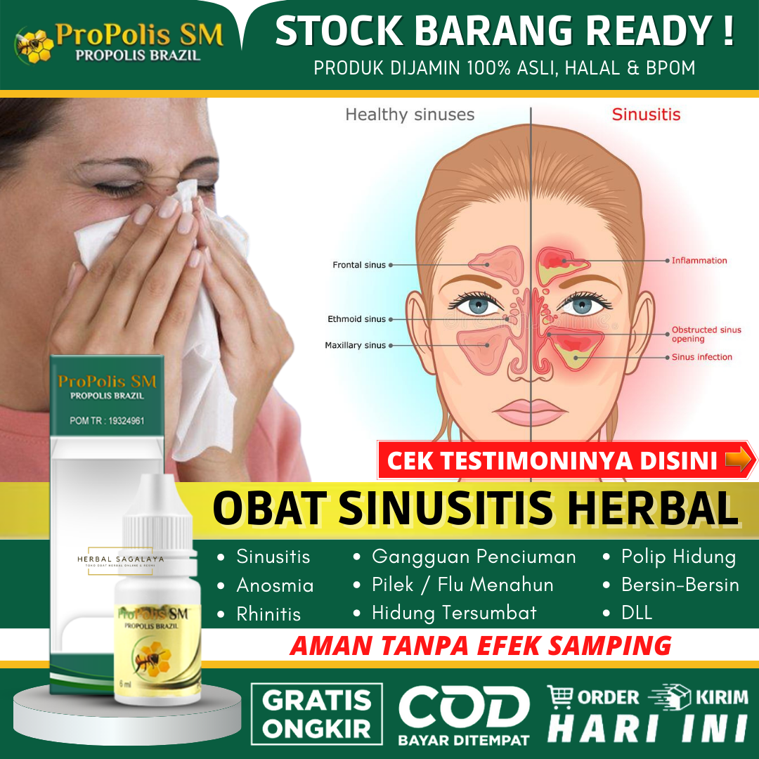 PROPOLIS SM Obat Sinusitis Herbal Alami Untuk Anak & Dewasa Sinusitis