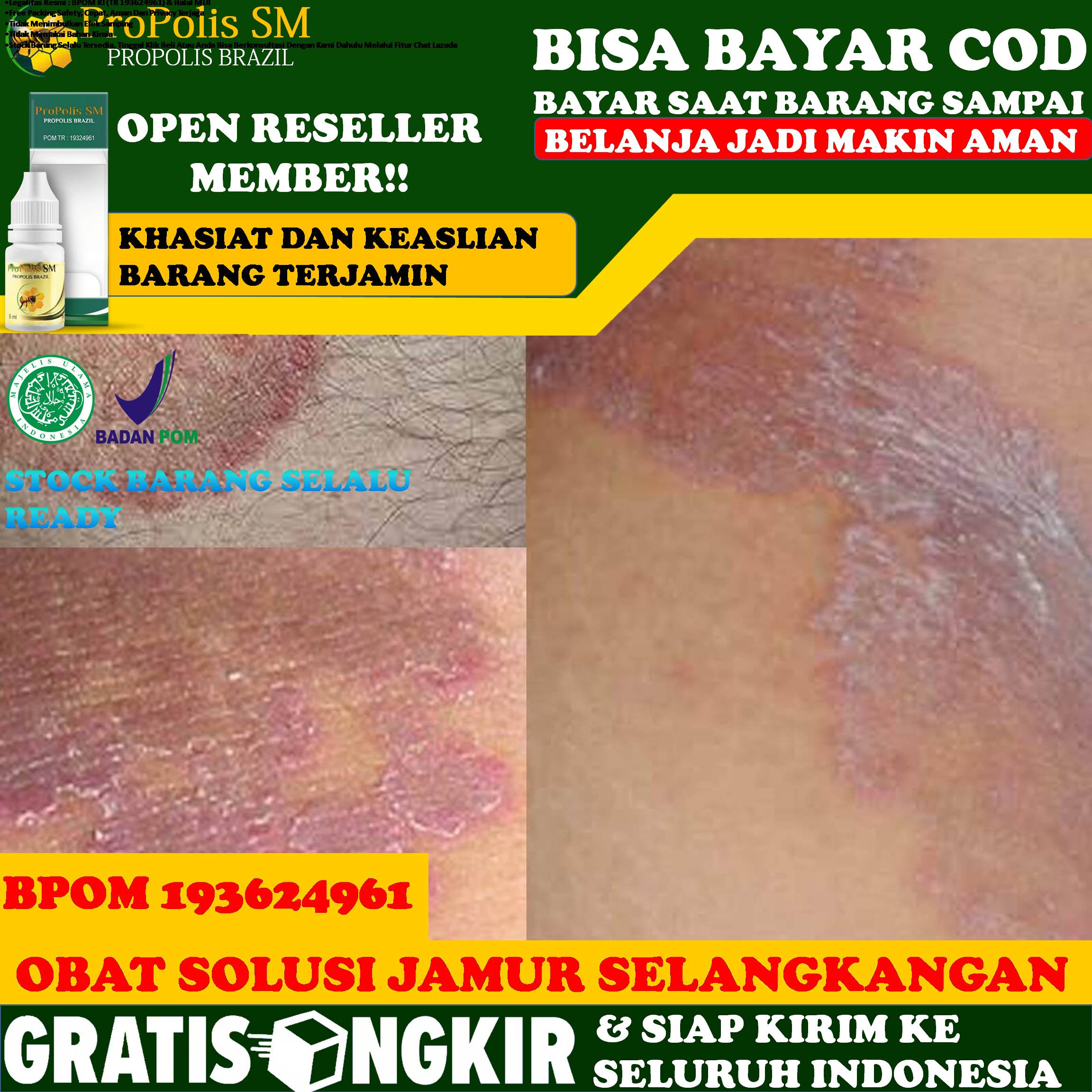 Jual Obat Pemutih Selangkangan Hitam Jamur Terbaru Lazada Co Id Jual Obat Pemutih Selangkangan Hitam Jamur Terbaru Lazada Co Id